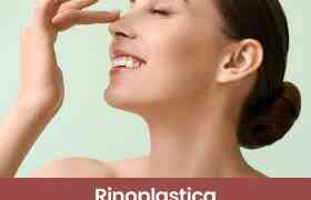 Rinoplastica: Migliorare la forma del naso e ridurre la gobba Dot. Vincenzo Galante
