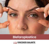 Blefaroplastica per occhi senza borse e palpebre cadenti Dott. Vincenzo Galante a Roma